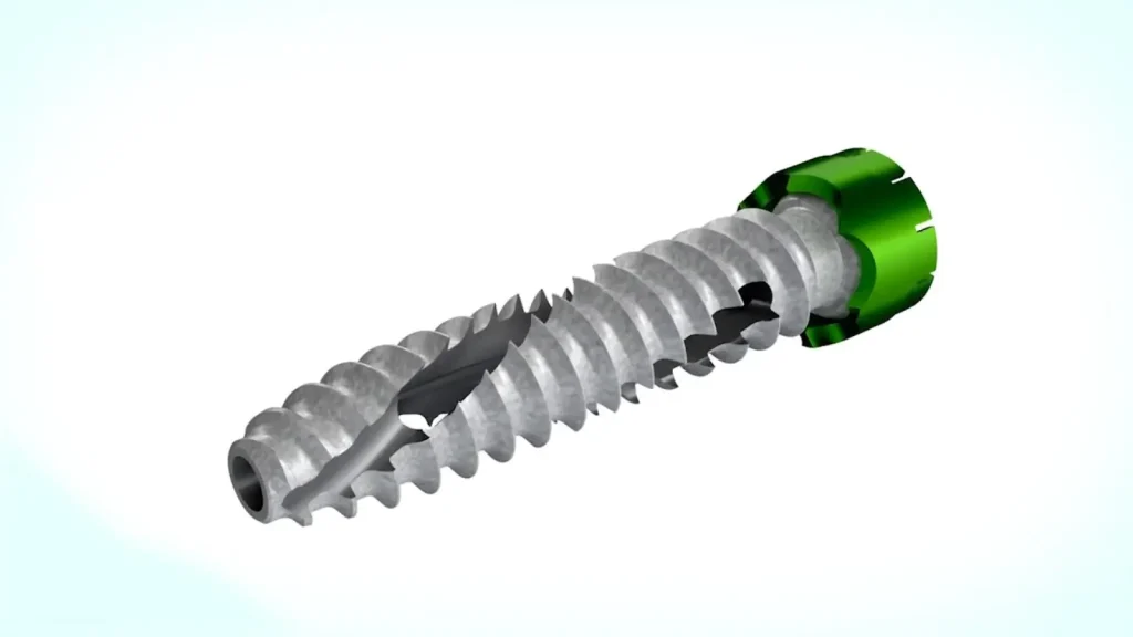 TriMech Tests Alevio Spine’s Implants Through SOLIDWORKS Simulation 7 Alevio Spine Device