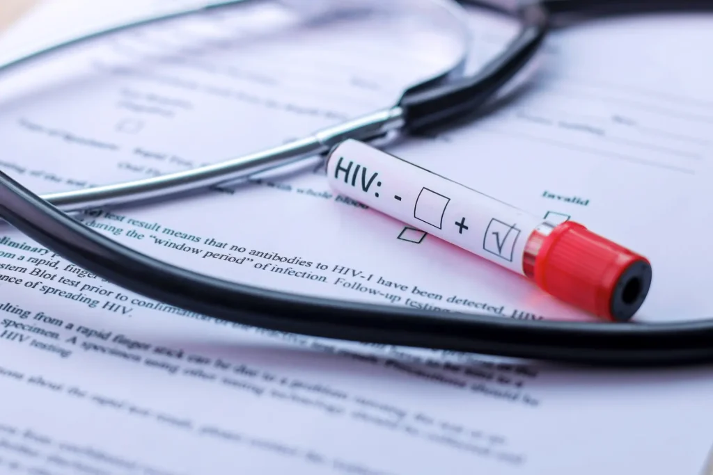 HIV patients prototype production